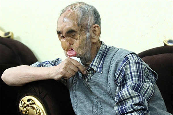 روایت مردی که جنگ صورتش را بُرد، در «بابا رجب» خواندنی می‌شود